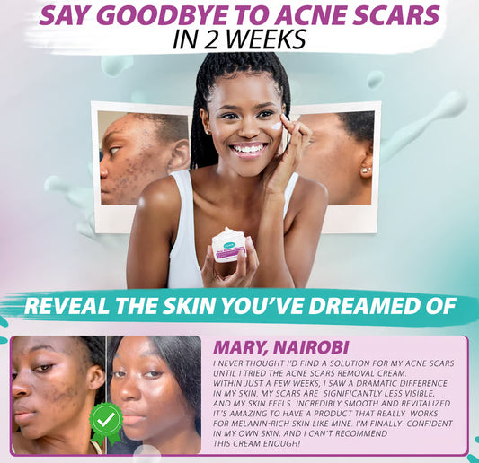 Scar Removal Cream (Nunua 1 Pata 1 Bure!)